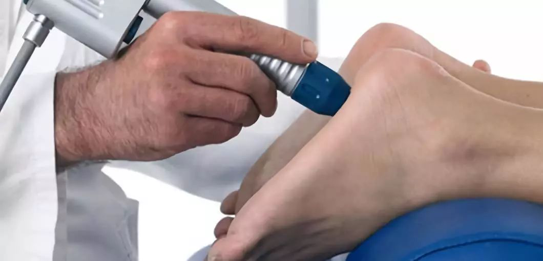 Prevention, treatment and recovery of Plantar Fasciitis | Ideastep