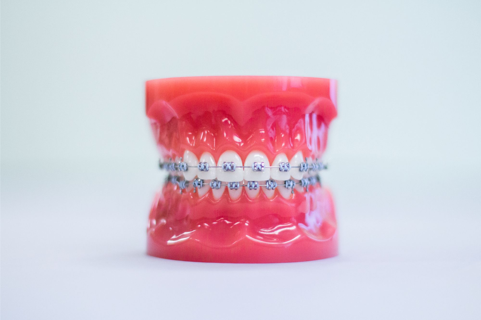 Metal Braces | Sugar Land Braces | Amaya Orthodontics