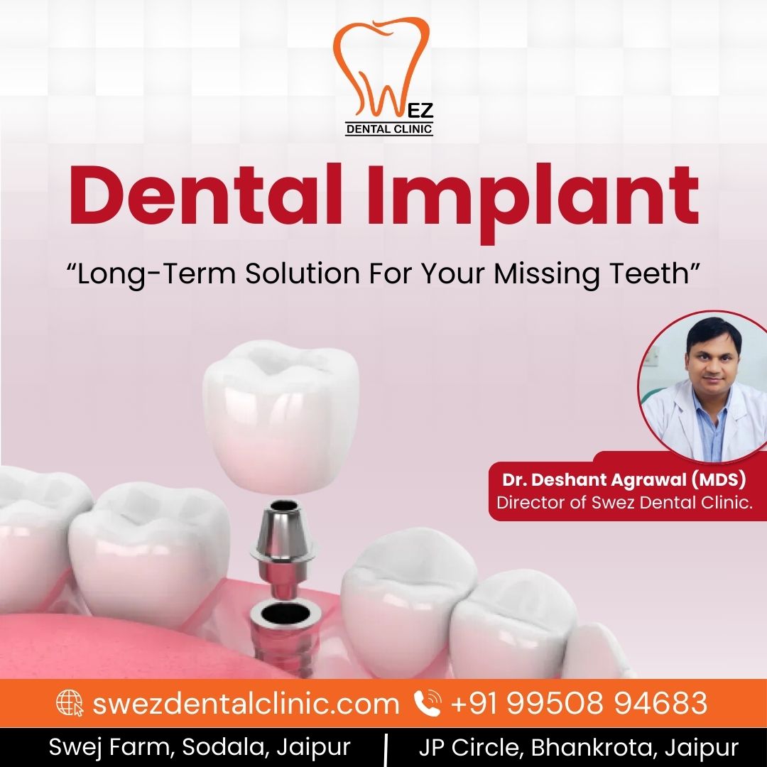 How Dental Implant Can Improve Your Health